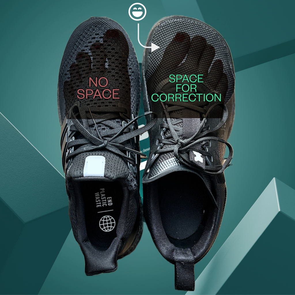 Custom-fit Footwear and Silicone Toe Separators: A Winning Combo to Combat Hallux Valgus